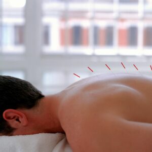 Acupuncture In Midtown NYC