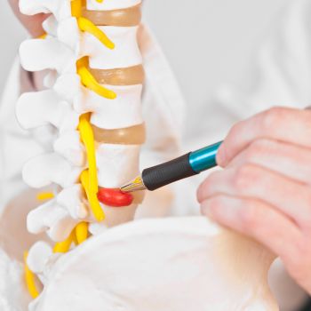 Herniated Disc Pain Management NYC
